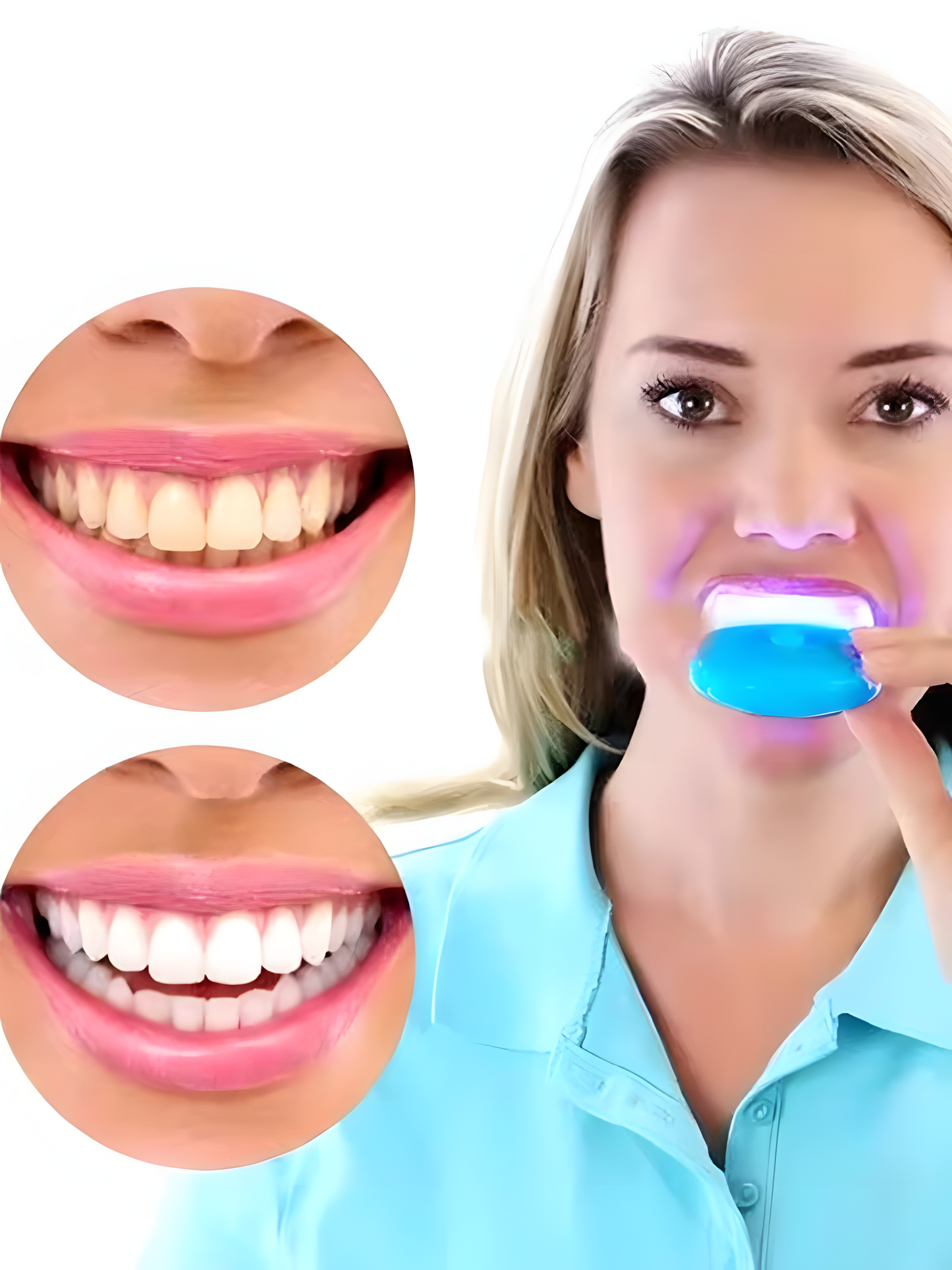 Dental White Mini Luz Blanqueadora para Dientes